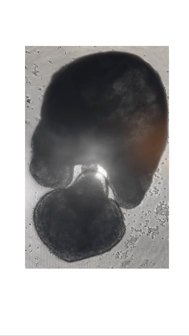 gif of organoid "digesting"