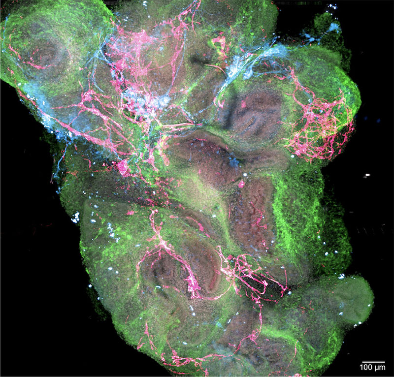 Magnified image of the organoid developed by Intero Biosystems